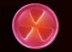 SEM image of Diatom frustule.